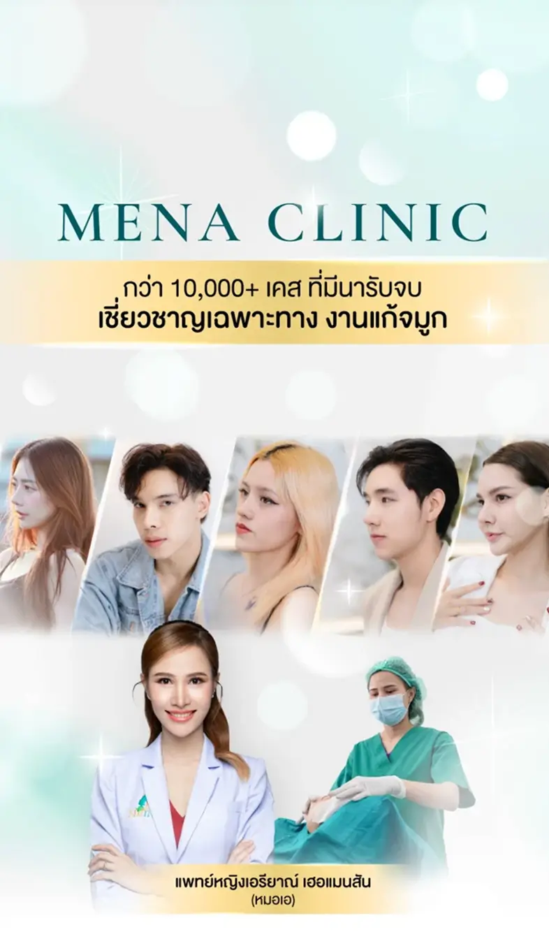 banner-mobile02