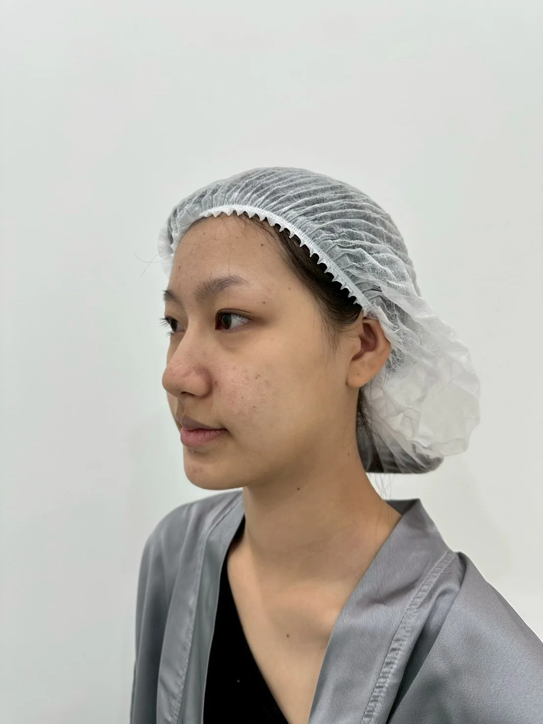 before-after11