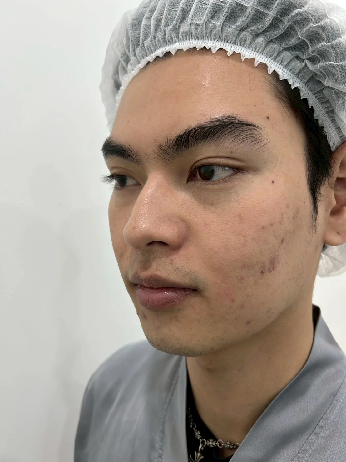 before-after2