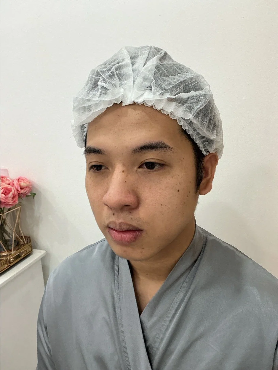 before-after31